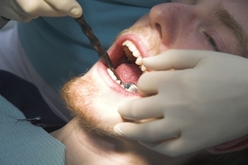 Čeští dentisté a jejich spolupracovníci jsou ohroženi toxickou rtutí zhruba dvakrát více než ostatní lidé (ilustrační foto).