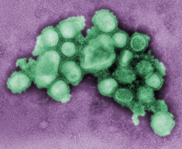 Virus prasečí chřipky pod mikroskopem. Letos zatím epidemie nepropukla, ale nakažených přibývá.