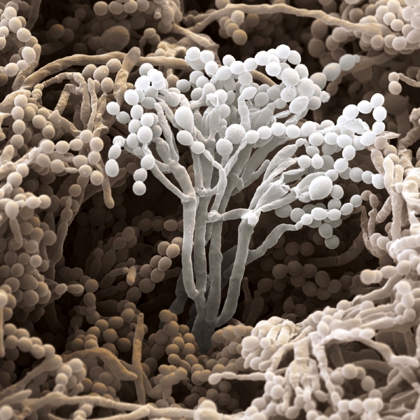 Mikrofotografie plísně Penicillium chrysogenum.