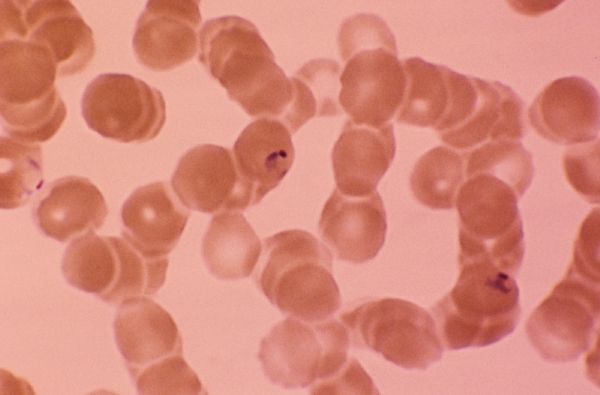 Zimnička Plasmodium falciparum v krvi.