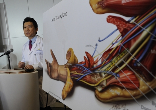 Lékaři stručně pro laiky vysvětlují, jak transplantace končetin vypadá. Lékaři stručně pro laiky vysvětlují, jak transplantace končetin vypadá.