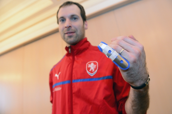 Petr Čech a jeho malíček.