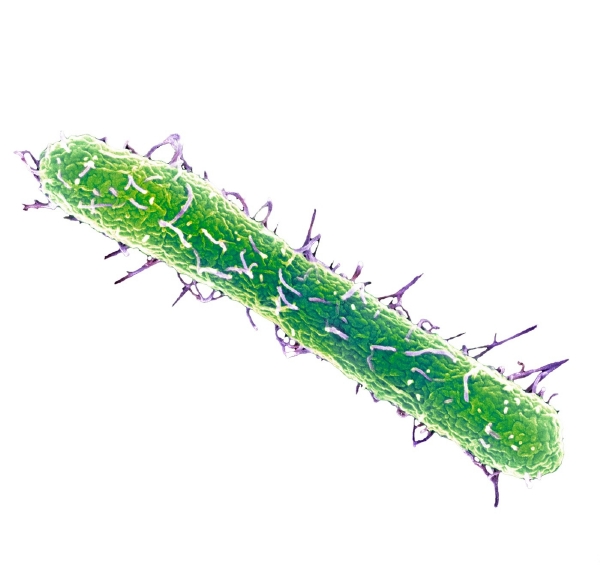 Salmonella typhimurium na snímku z elektronového mikroskopu.