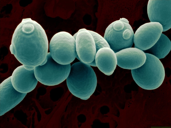 Kvasinka Saccharomyces cerevisiae.