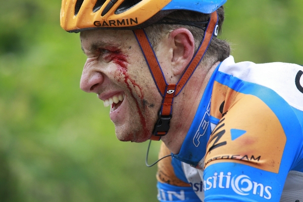 O krvavé šrámy není na Tour de France nouze.