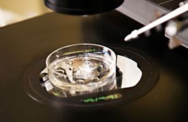 Oplodnění in vitro (ilustrační foto).