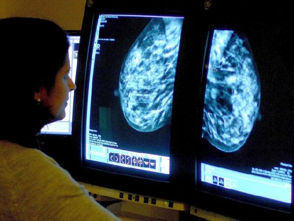 Vyšetření na mamografu odhalí skrytá rakovinová ložiska, která žena sama nemůže odhalit (ilustrační foto). Vyšetření na mamografu odhalí skrytá rakovinová ložiska, která žena sama nemůže odhalit (ilustrační foto).