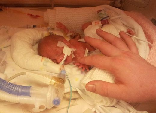 Lékaři malé Esme nepředpovídali světlou budoucnost. K jejímu přežití byli zpočátku velmi skeptičtí.