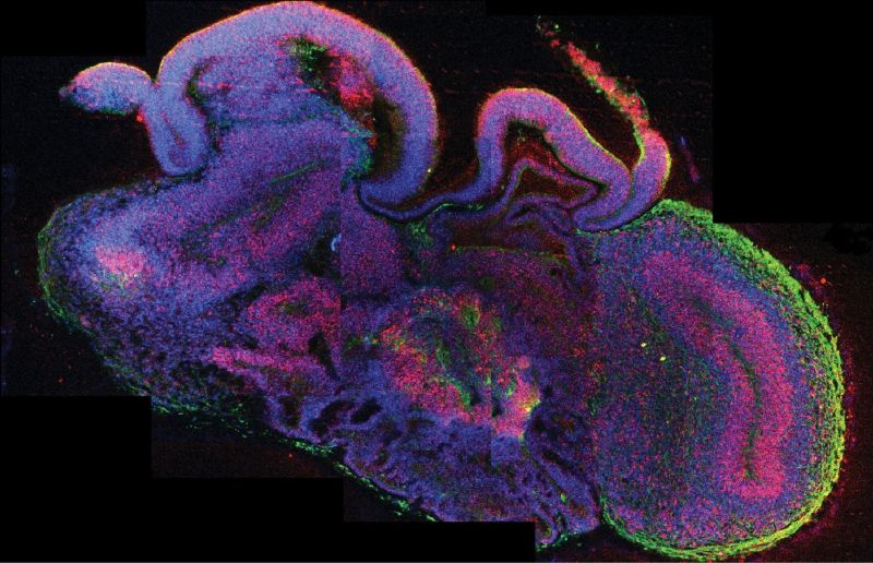 Budoucnost výzkumu mozku - cerebrální organoid.
