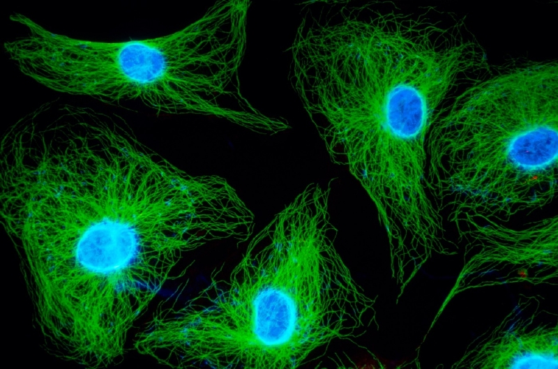 Buňky cévní výstelky na snímku z fluorescenčního mikroskopu.