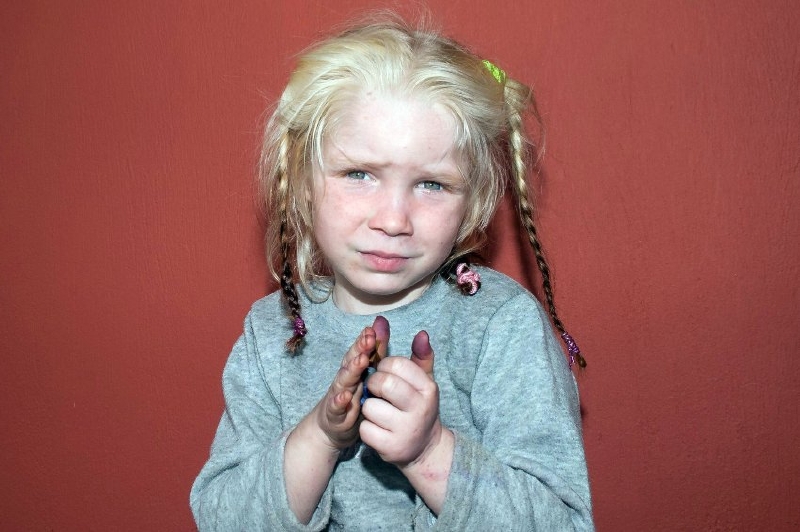 Dívka, kterou řecké úřady odebraly rodině v romském ghettu.