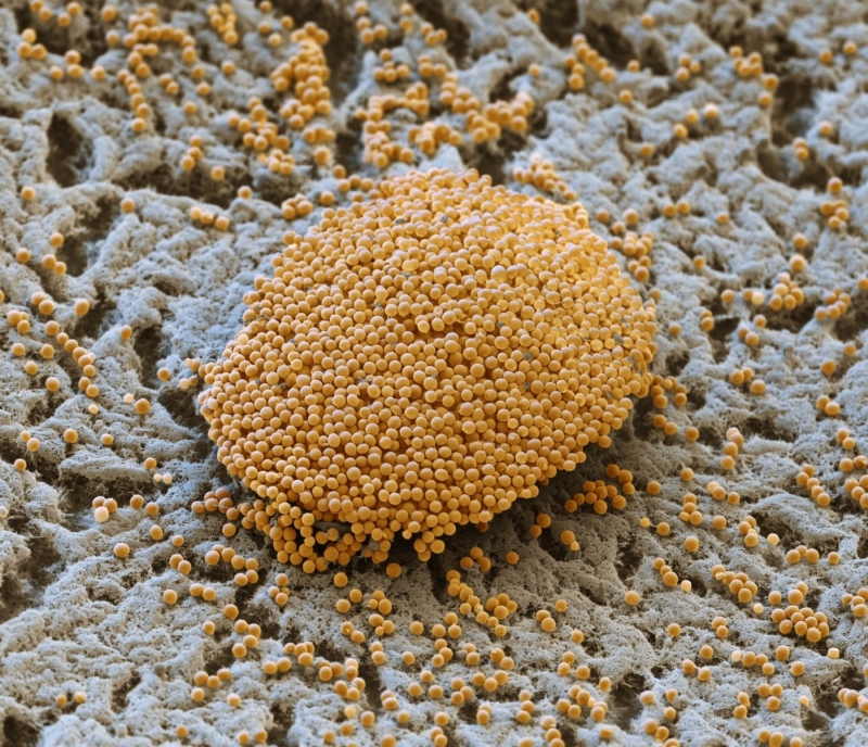 Společná plodnice bakterie Myxococcus xanthus.