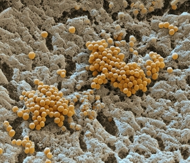 Buňky bakterie Myxococcus xanthus na snímku z elektronového mikroskopu.