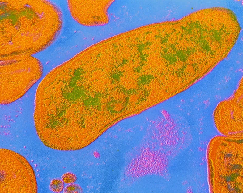 Buňky blíže neurčené bakterie rodu Acinetobacter na počítačem upraveném snímku z elektronového mikroskopu.