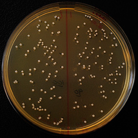 Kolonie Acinetobacteru na Petriho misce.