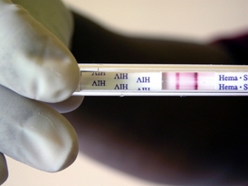 Testovací proužek na HIV.