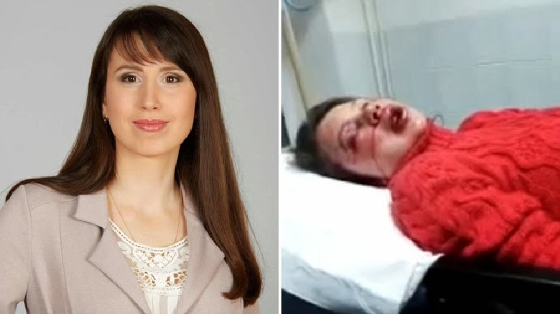 Teťjana Čornovolová před a po přepadení. Teťjana Čornovolová před a po přepadení.