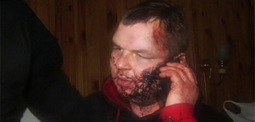 Aktivista ukrajinské opozice Dmytro Bulatov byl týden nezvěstný.