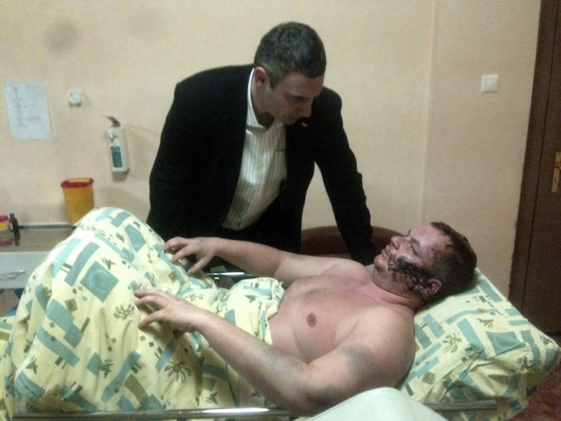 Opoziční aktivista Dmytro Bulatov.