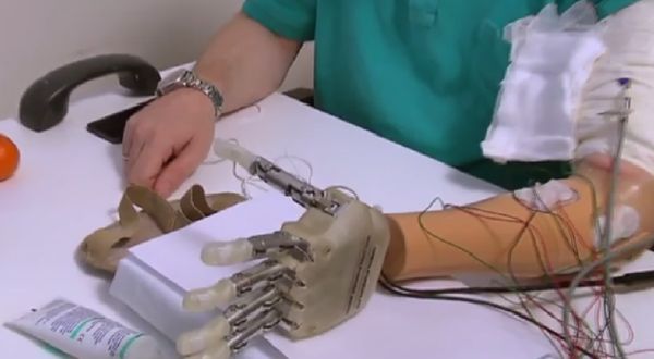 Dennis Sorensen se dočkal nové ruky. A to se vším všudy.