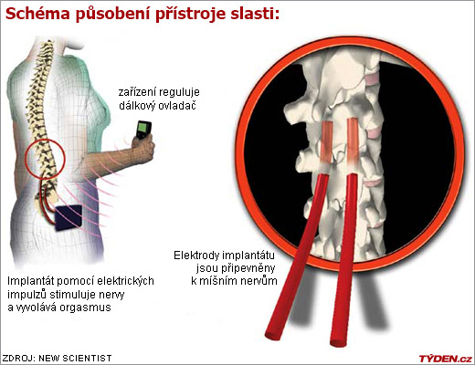 Schéma působení přístroje slasti.