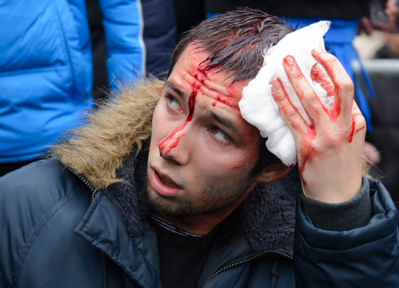 Do křížku se dostala militantní skupina stoupenců postupu Ruska na Krymu s ukrajinskými radikály. Do křížku se dostala militantní skupina stoupenců postupu Ruska na Krymu s ukrajinskými radikály.
