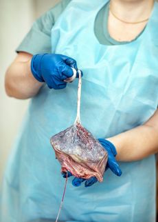 Zdravotní sestra s placentou.