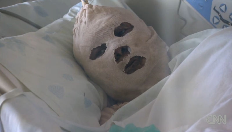 Marjam Chavlíová se ze zoufalství pokusila upálit. Marjam Chavlíová se ze zoufalství pokusila upálit.