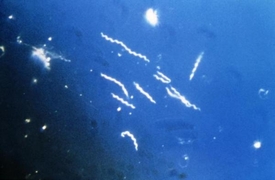 Buňky bakterie Borrelia burgdorferi vypadají jako vývrtky.