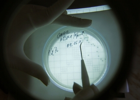Počítání kolonií bakterie Escherichia coli.