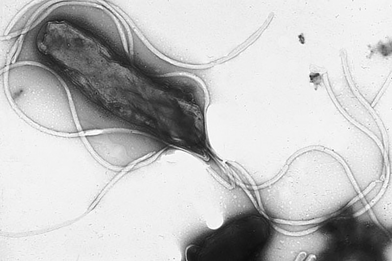 Bakterie Helicobacter pylori se proslavila coby původce žaludečních vředů.