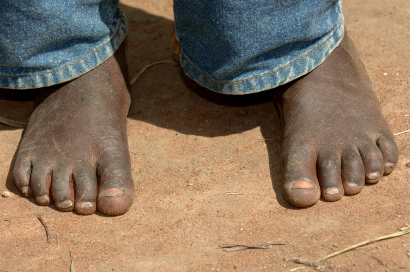 Vědci nabídli v experimentu africkým zemědělcům volbu mezi cukrem nebo penězi pro sebe a botami pro jejich děti.