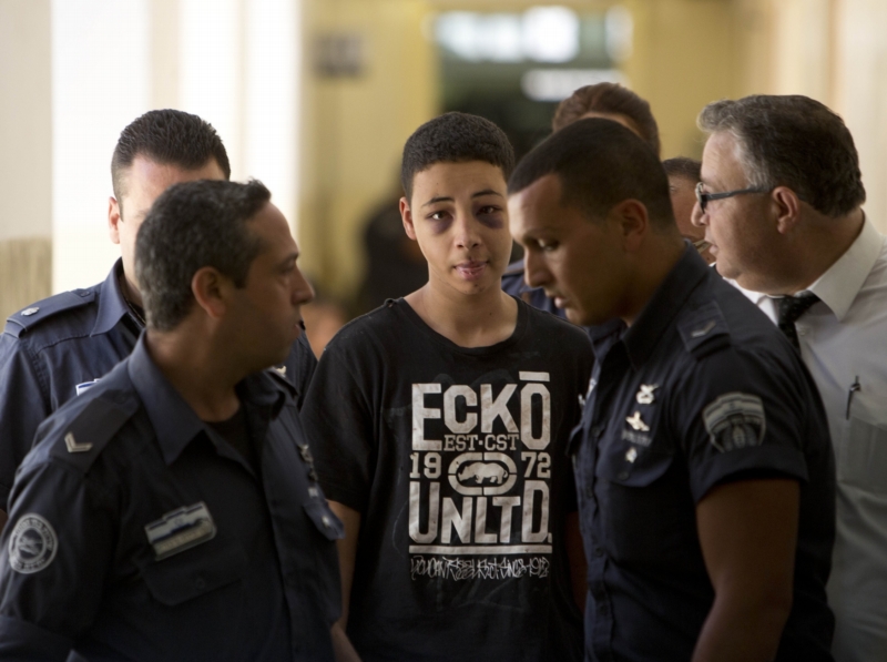 Tariq Abu Khdeir, 15, americký občan, byl podle slov svých příbuzných zbit izraelskou policií. Zatčen byl při nepokojích, které následovaly po vraždě jeho bratrance Mohammeda Abu Khdeira. Tariq Abu Khdeir, 15, americký občan, byl podle slov svých příbuzných zbit izraelskou policií. Zatčen byl při nepokojích, které následovaly po vraždě jeho bratrance Mohammeda Abu Khdeira.