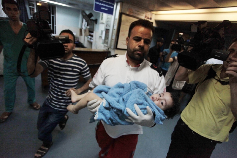 Palestinské dítě zraněné při bombardování.