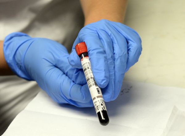 Nejčastěji do laboratoře doputuje vzorek s čárovým kódem. Po jeho načtení se laborantka v počítači dozví potřebné údaje o pacientovi.
