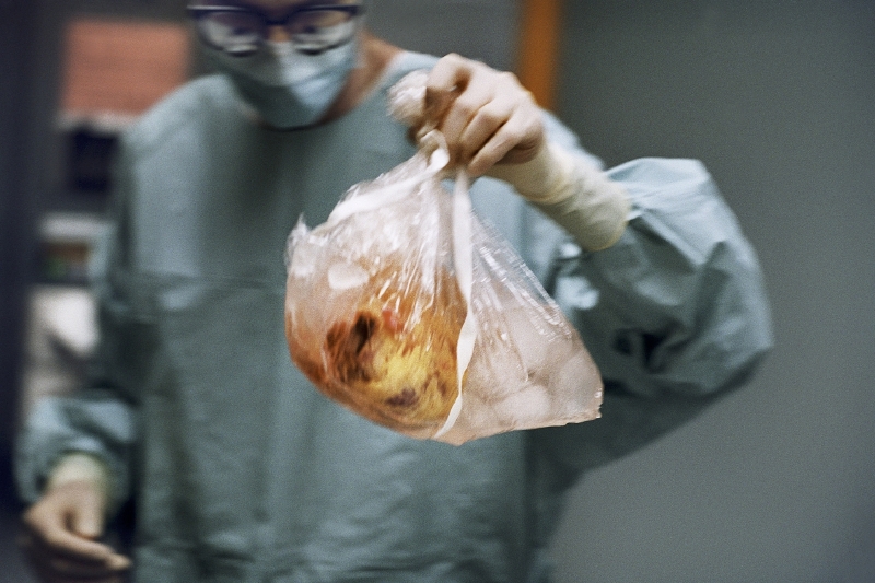 Srdce určené k transplantaci (ilustračení foto).