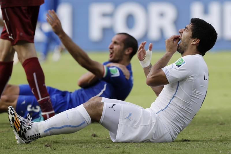 Uruguayský útočník Luis Suárez kousl italského obránce Giorgia Chielliniho na fotbalovém mistrovství světa. Uruguayský útočník Luis Suárez kousl italského obránce Giorgia Chielliniho na fotbalovém mistrovství světa.