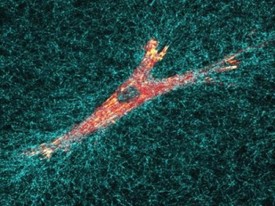 Fibroblast v trojrozměrné matrici.