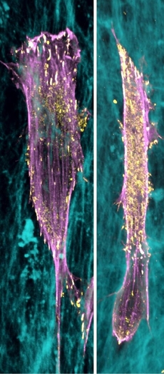 Fibroblast při pohybu po plochém podkladu (vlevo) a v trojrozměrném prostředí (vpravo).