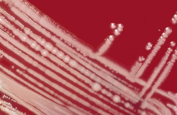 Bakterie Pseudomonas aeruginosa rostoucí na agaru.