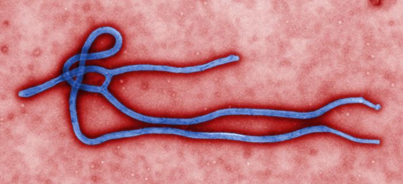 Virus ebola. Virus ebola.