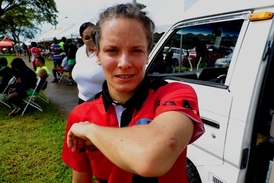 Věra Samková ukazuje kousanec od trinidadské policistky.
