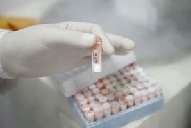 Zkumavka s kmenovými buňkami.