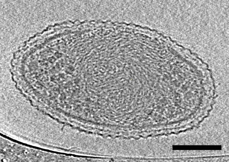 Nejmenší bakterie na světě. Měřítko představuje sto nanometrů (miliardtin metru).