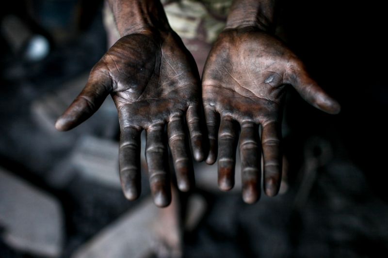 Žloutenka A se přenáší dotekem, kontaminovanou vodou, potravinami a znečištěnými předměty.