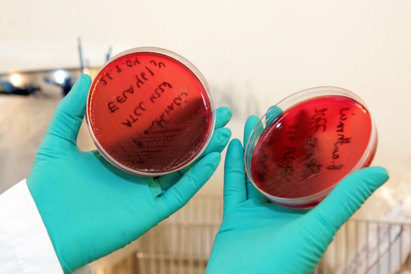 Vzorky antraxu v laboratorních podmínkách. Vzorky antraxu v laboratorních podmínkách.