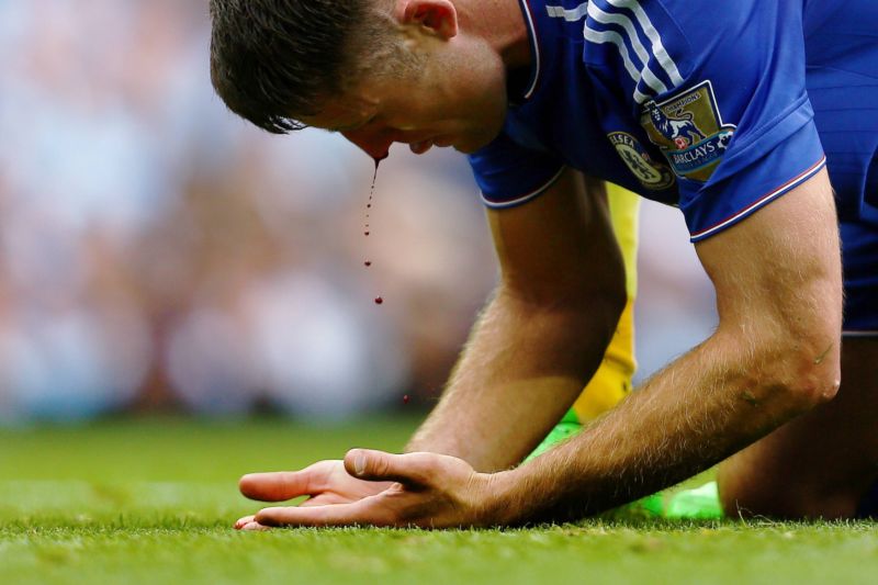 Obránce Chelsea Gary Cahill krvácí po jednom ze střetů. Hra Chelsea krvácí ale mnohem více. 