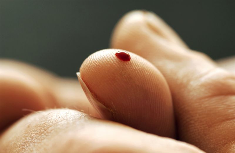 Počet českých pacientů, kteří trpí hemofilií, se podle lékařů nezvyšuje.