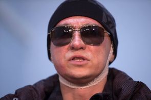 Šéf Velkého divadla Sergej Filin, kterého oslepil útok kyselinou.