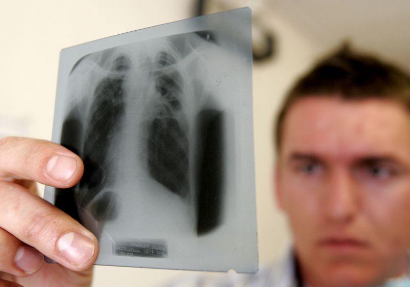 Výsledky laboratorního vyšetření potvrdily negativní výsledek (ilustrační foto). Výsledky laboratorního vyšetření potvrdily negativní výsledek (ilustrační foto).